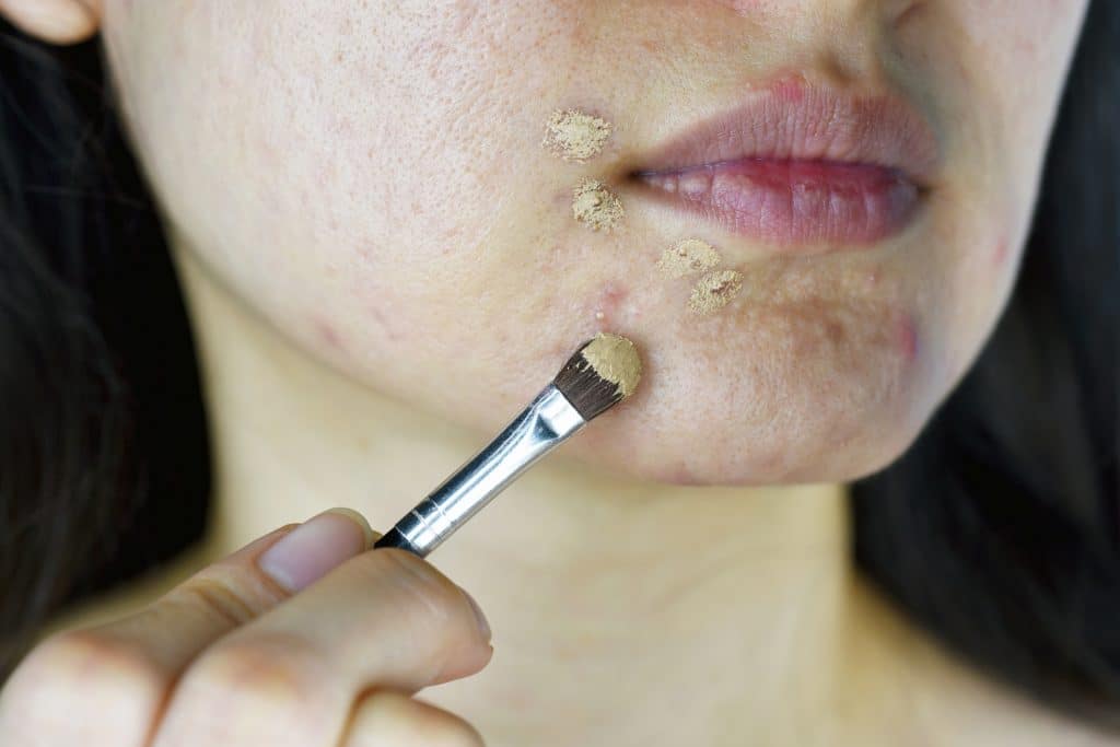 A woman with acne cosmetica applying make up