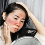 Cover image for the article "Rosacea vs. Seborrheic Dermatitis"
